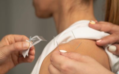 How Can Acupuncture Help Relieve Pain?