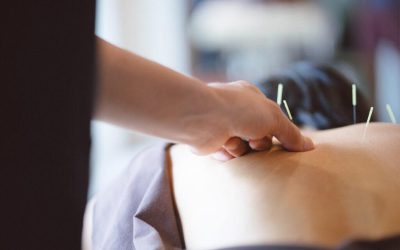 Does Acupuncture Support the Body’s Natural Healing Ability?