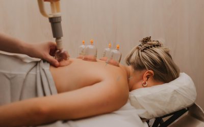 Cupping Therapy