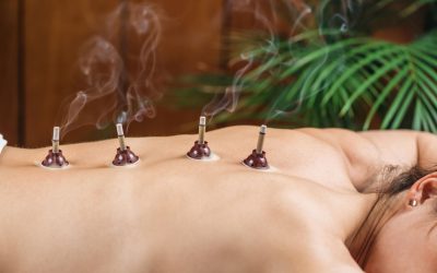 Moxibustion Therapy